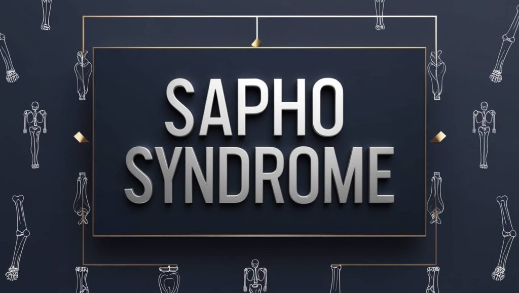 SAPHO Syndrome | Causes, Symptoms, and Treatments